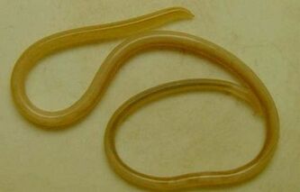 Arten von Parasiten im menschlichen Körper