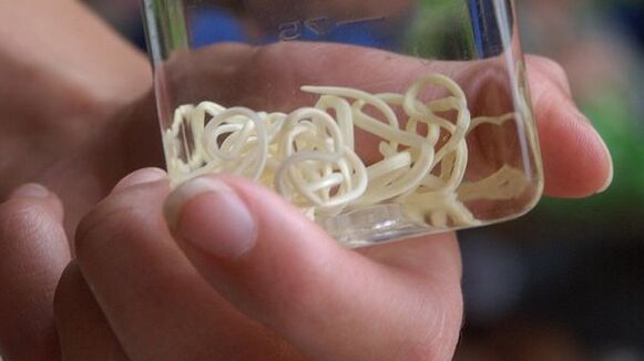 Filaria-Würmer ähneln im Aussehen einem langen Faden