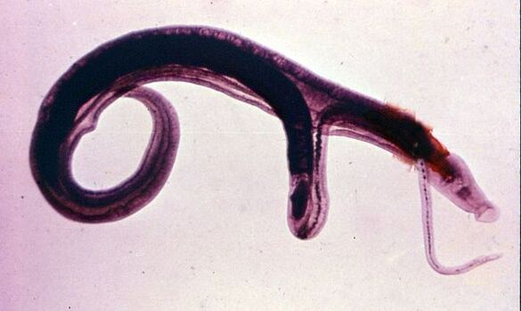 Schistosomen gehören zu den häufigsten und gefährlichsten Parasiten